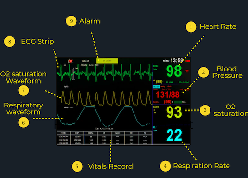 How To Read About Patient Vital Signs Monitor Rooemed